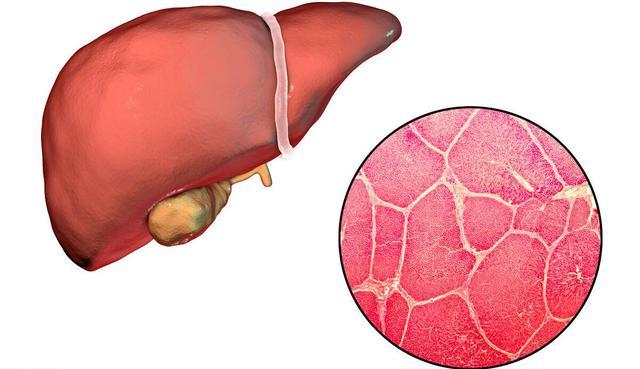 分解以及多個方面的健康問題,如果肝臟功能衰竭喪失,就會危及生命