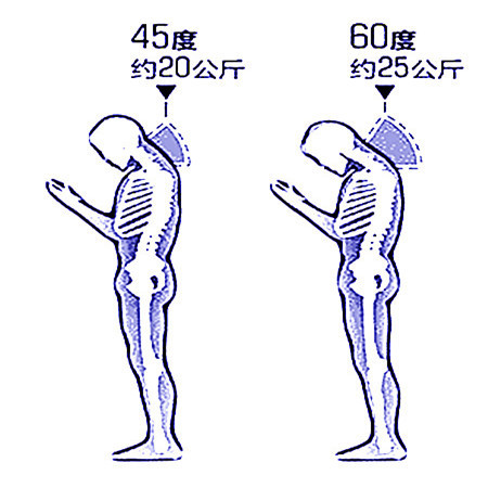 小伙儿长时间低头玩手机导致颈椎病