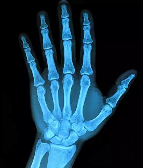 7招锻炼法,告别手部关节炎-蔡谞主任医师-爱问医生