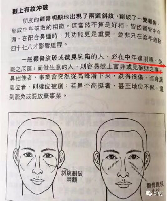 朋友的颧骨明显的出现了两道斜纹,削破了一双颧骨,形成中年破败的相徵