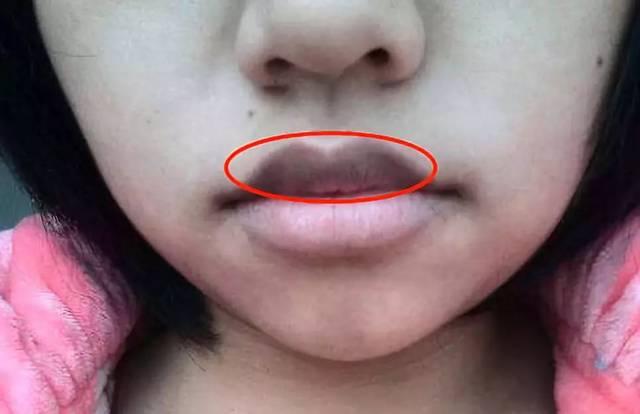 身体在缺氧的情况下,嘴唇的颜色会发生变化,会正常的粉红色慢慢变成暗