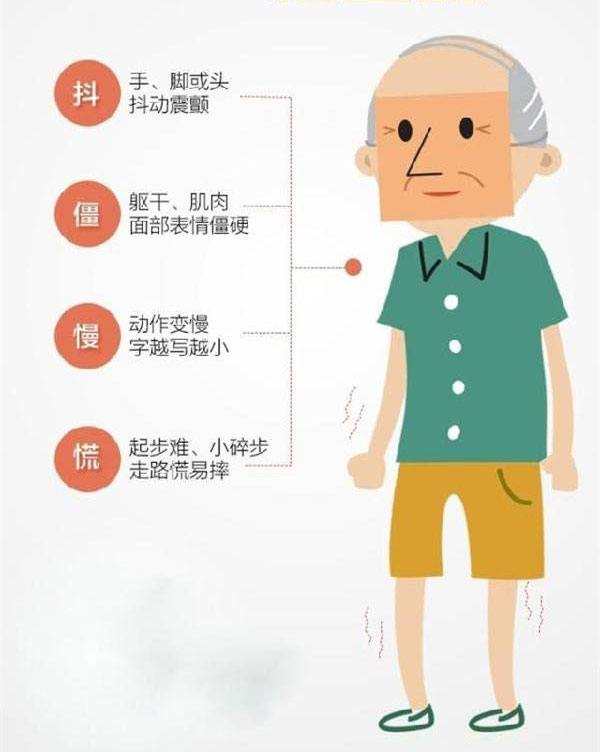 帕金森病患者如何用药效果最佳