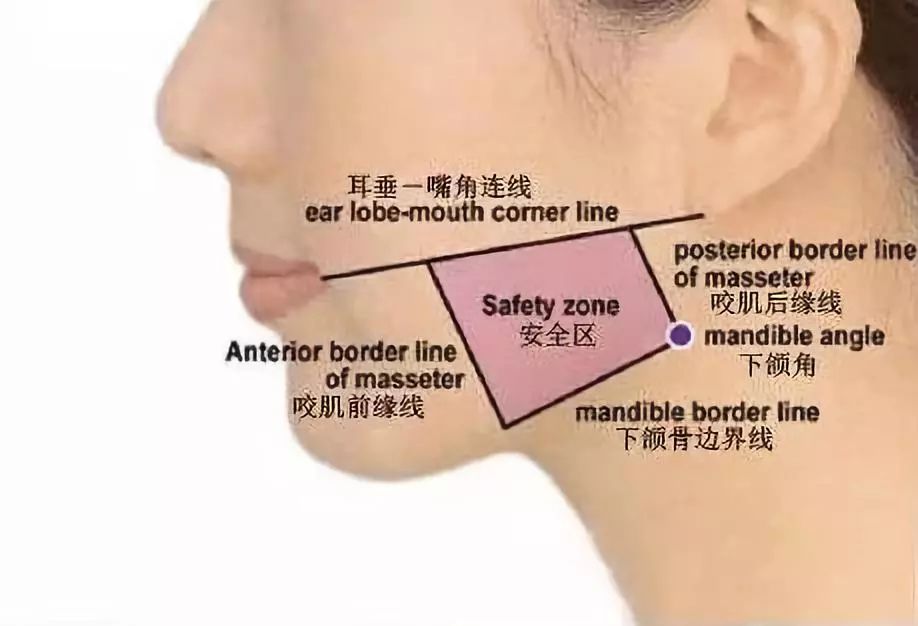 肉毒素注射位置有偏差到底为什么有些人打完之后脸会僵呢?