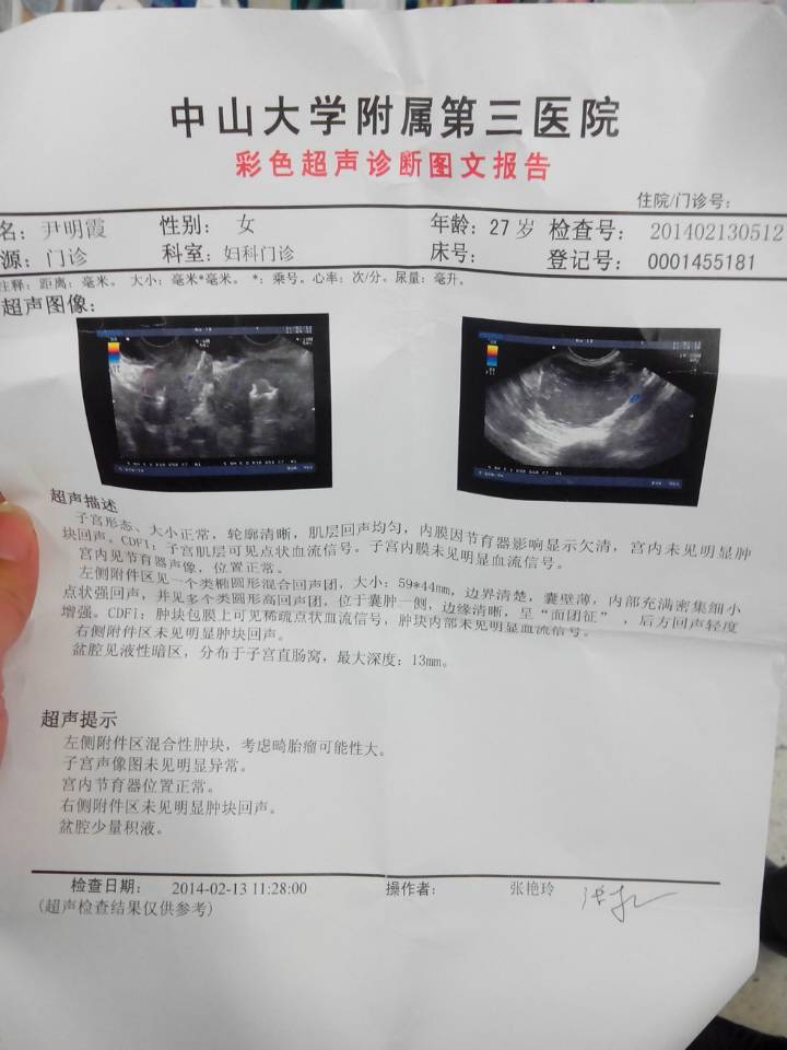 畸胎瘤图片病理报告图片