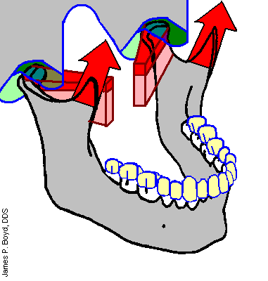 牙齿与关节(颞下颌)的那些事