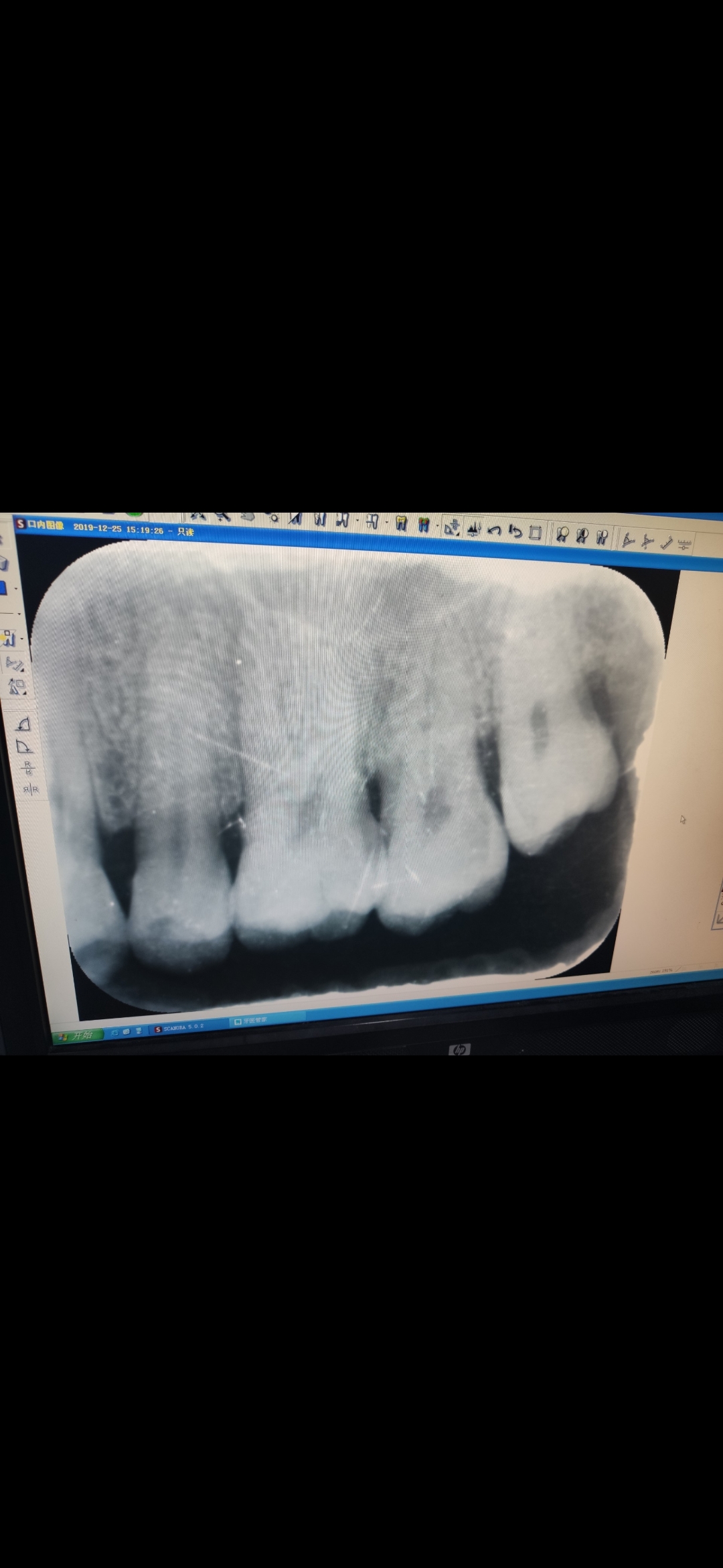 牙科影像学检查和作用(孕期能否拍摄?
