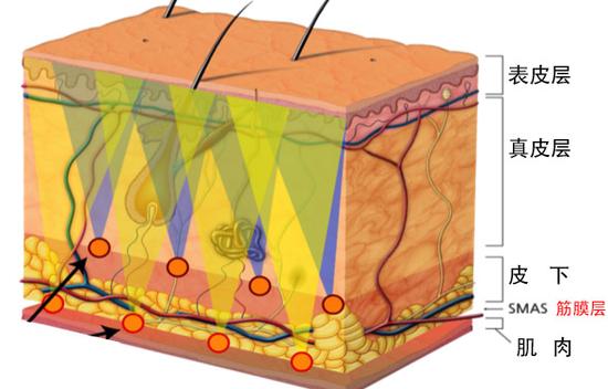 想要了解超声刀原理效果及副作用等,先需要了解面部衰老的原因:面部