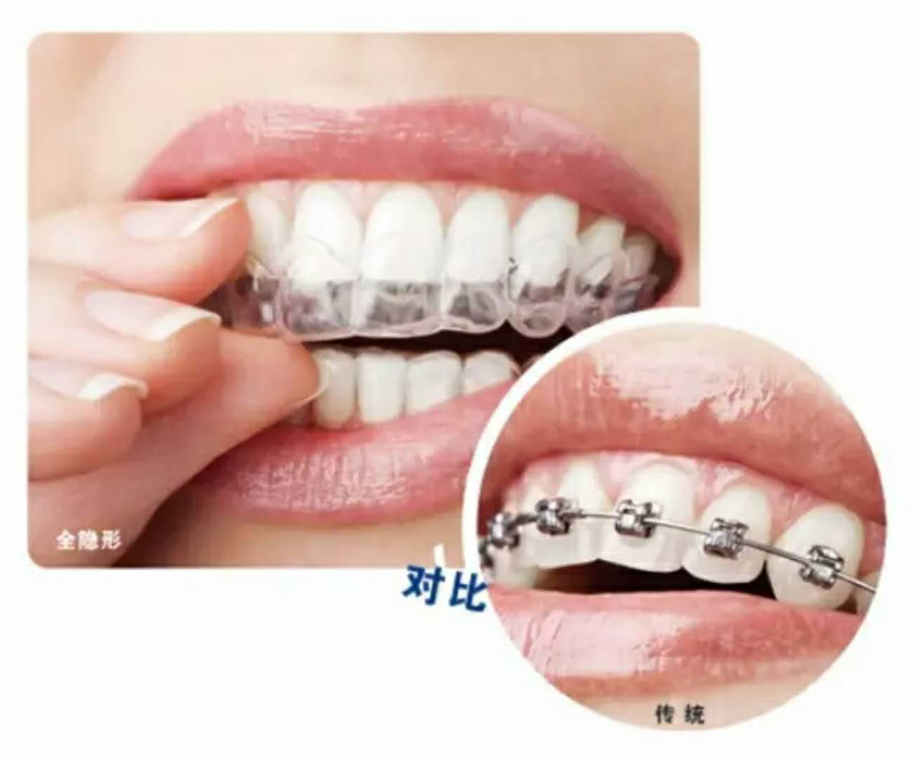 成人矫正