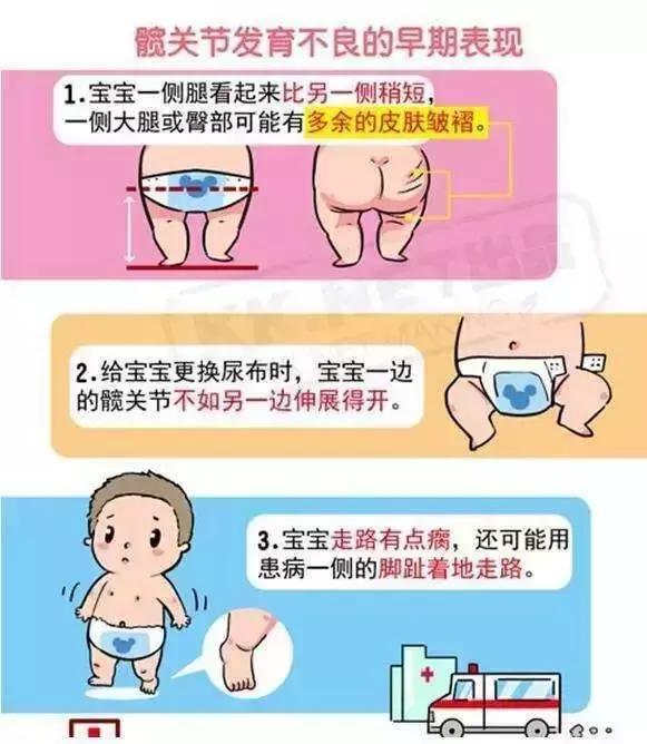 宝宝长短腿,跛行,走"鸭步",或是ddh,早发现可不做手术