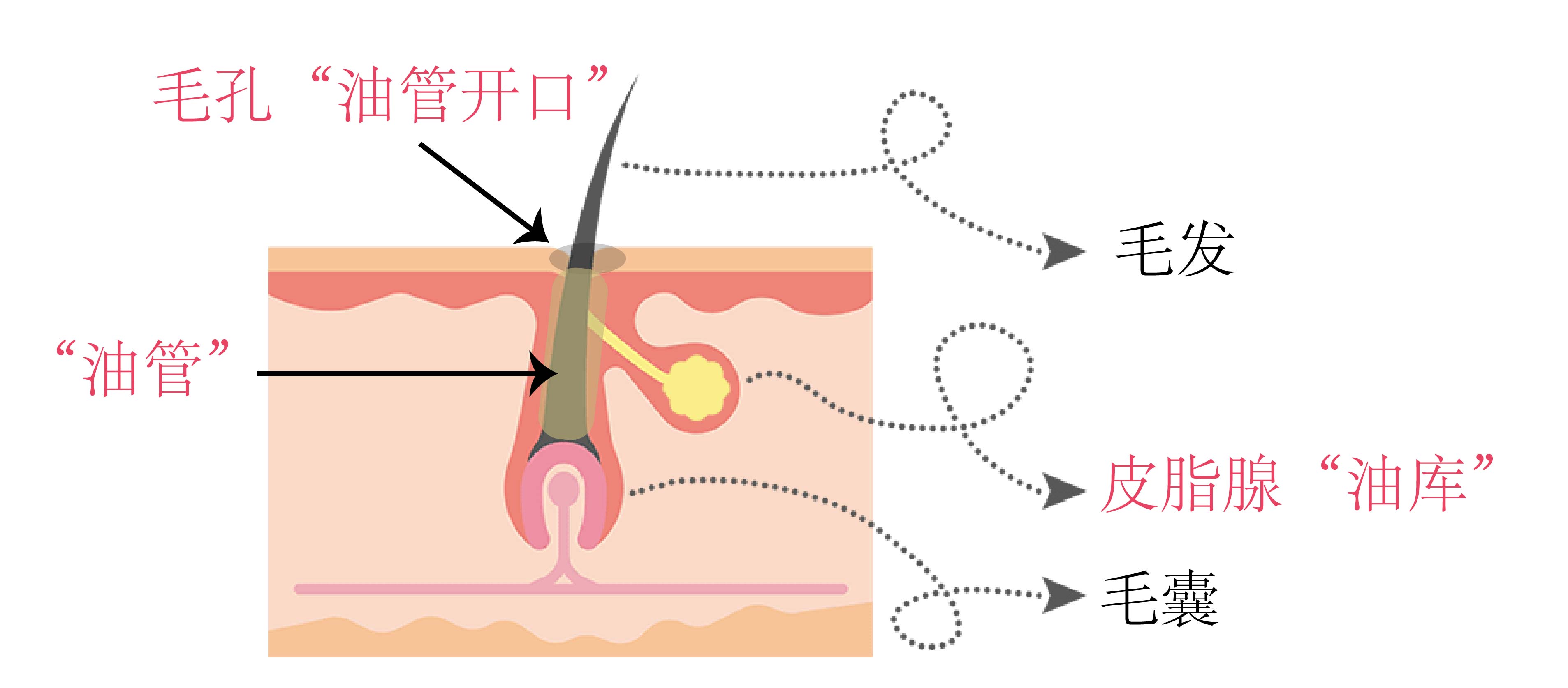 毛孔粗大?那是因為