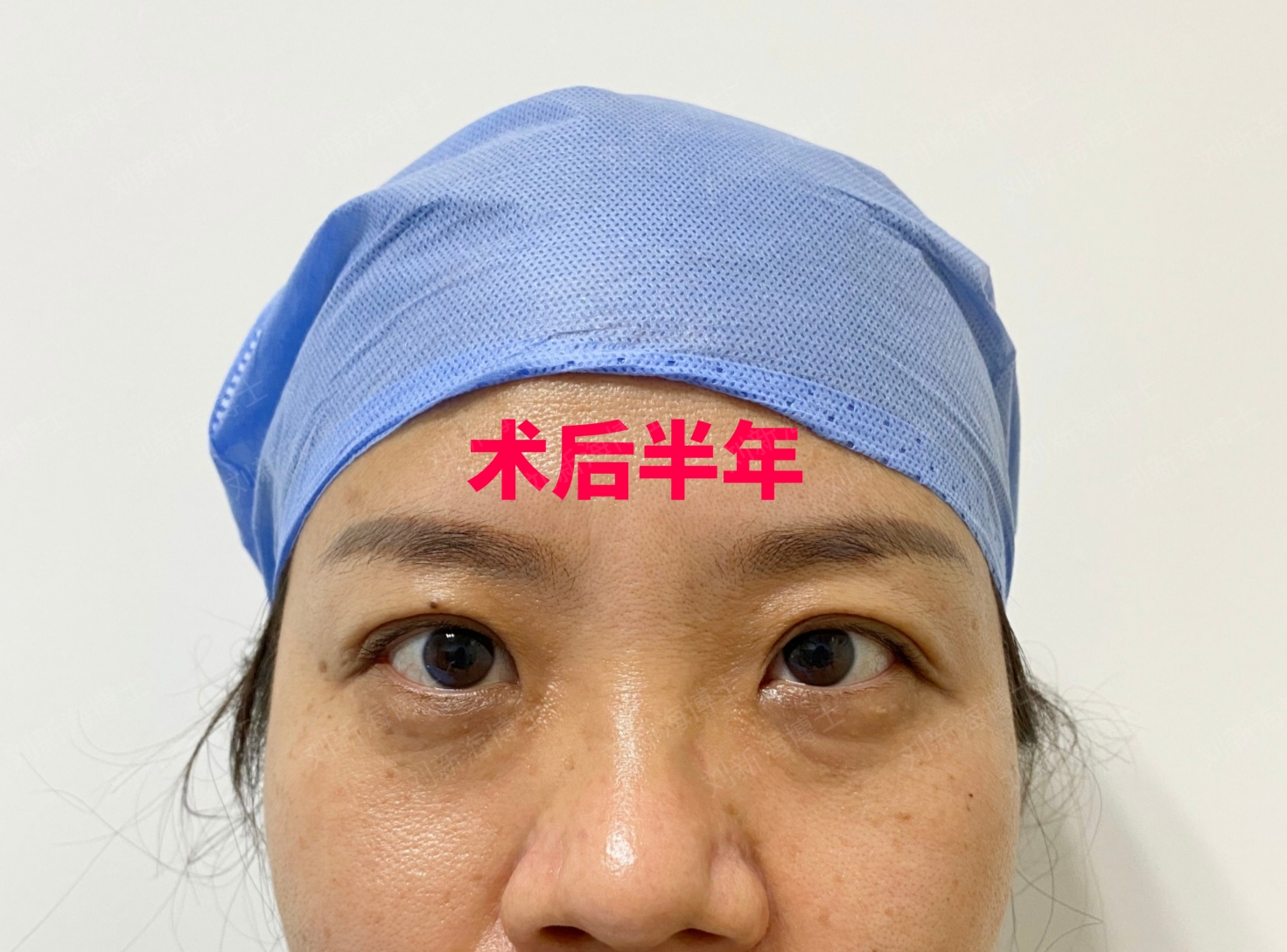 回答朴相炫医生修复双眼皮怎么样/多少钱,高难度眼修复找他,眼部失败手术修复-8682赴韩整形网