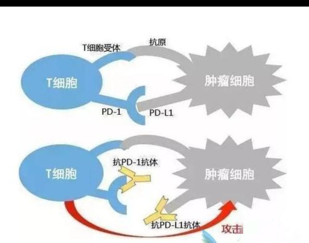 pd1治疗癌症的原理是什么