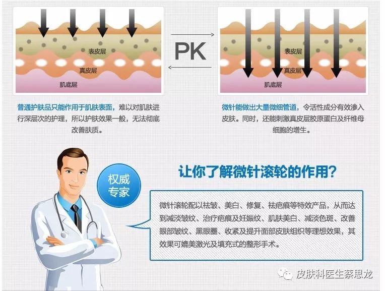 带你了解微针-蔡思龙副主任医师-爱问医生