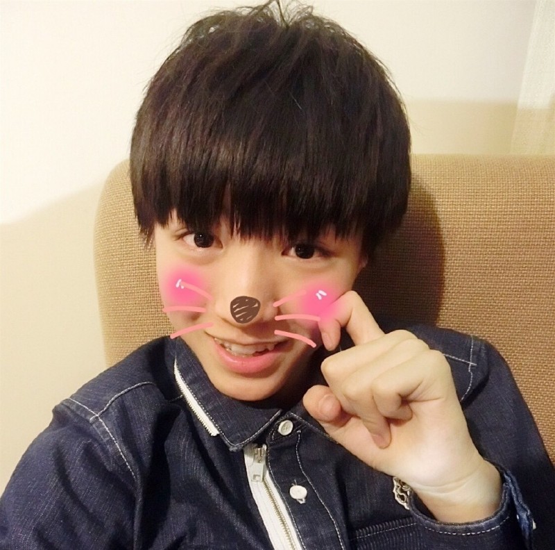 超可爱的虎牙王俊凯为什么还要去矫正