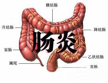 1,病毒性肠炎病毒性肠炎见于犬瘟热病毒,犬细小病毒,犬猫冠状病毒,猫