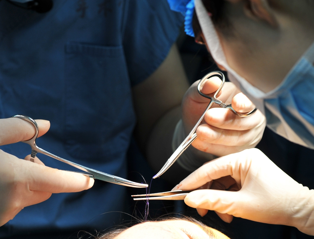 线雕技术与价格你更注重哪一个