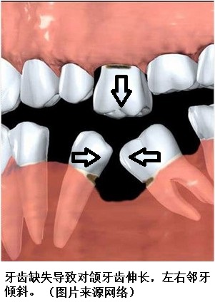 什么是六龄齿,六龄齿长出来还会换吗?