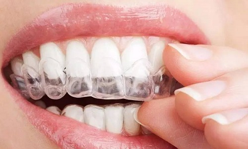 如何正确的佩戴牙套?隐形牙套摘戴有技巧!_王艳艳__爱问健康