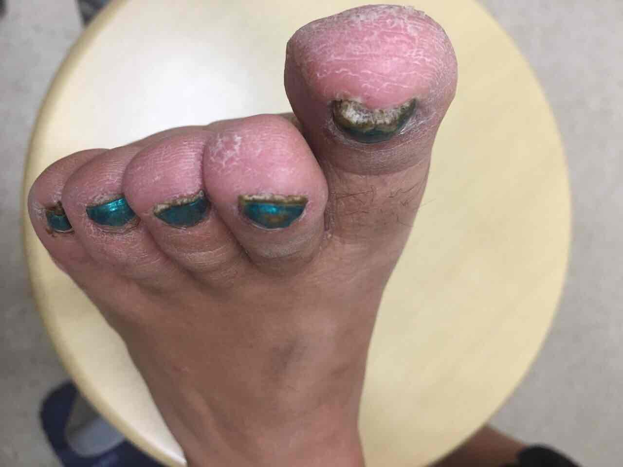 你的身上长"蘑菇了吗?"(一)_张红娟_副主任医师_爱问健康