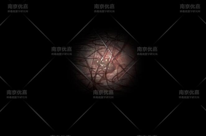 阴囊上面长菜花状_张磊_其他_爱问健康