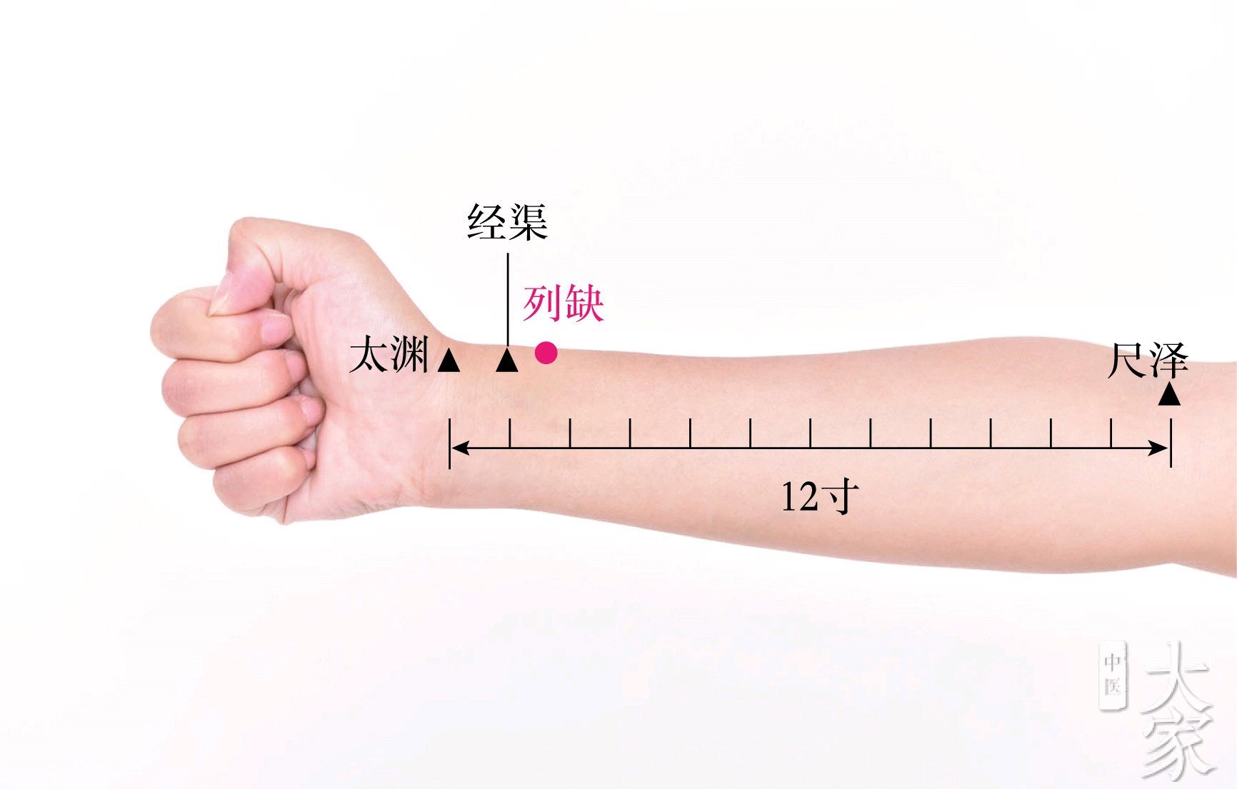 小小针灸治咽痛