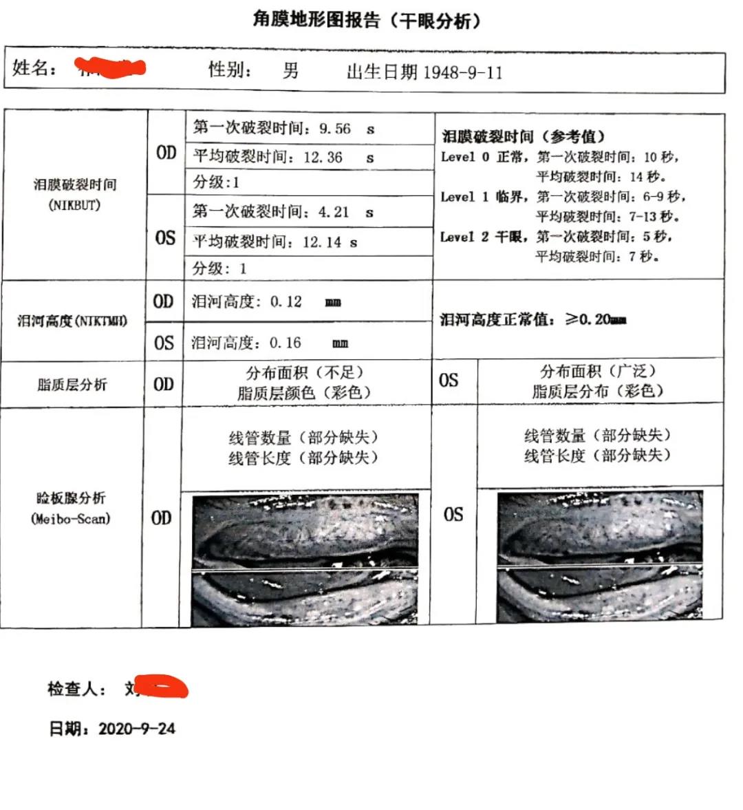 ubm—超声生物显微镜 ubm可以观察到睫状体和周边虹膜的位置,成角