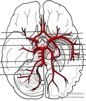 颅内动脉环解剖图图片