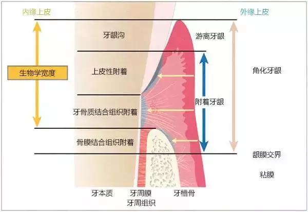 斑吸收唾液中的养分不断繁衍,慢慢沉积在下前牙的舌侧和上后牙的颊侧