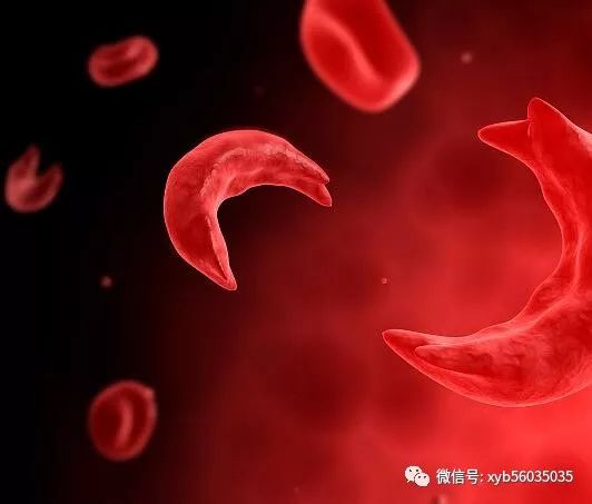 因血浆容量减少,血液浓缩,而红细胞量并不增多,发生于严重脱水,大面积