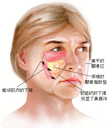 肌肉和脂肪的形态:40%其实,面部年轻程度是由以下几个主要因素决定