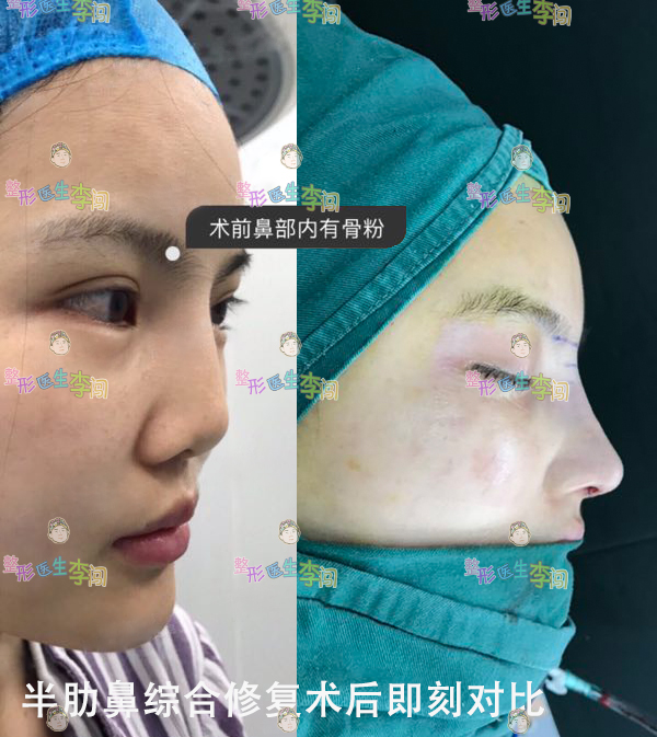 综上所诉,不要听信别人说的骨雕优势多么吸引人,就算是合法的材料会