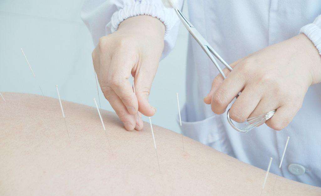 针灸对腰椎间盘突出症患者有什么用?