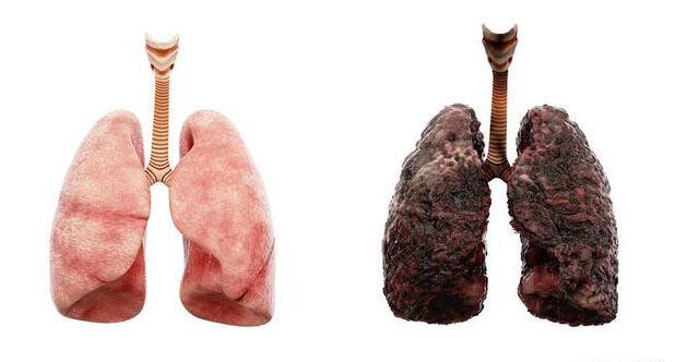 吸烟的肺图片恶心图片