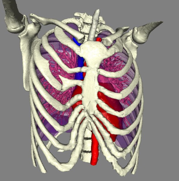 胸廓畸形最新三維成像技術-王文林主任醫師-愛問醫生