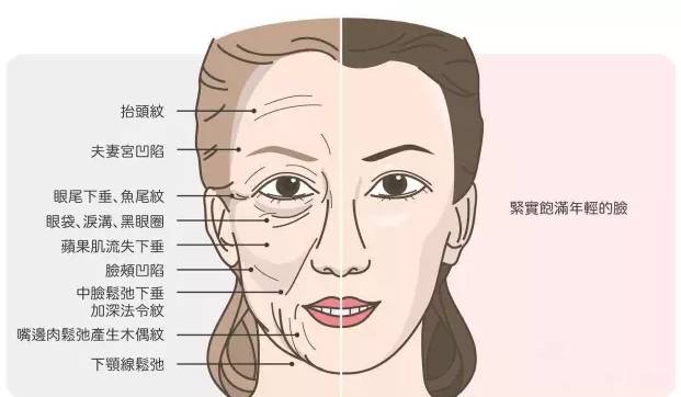 干货丨法令纹分3型,你是哪一型?-张胜昌主治医师-爱问医生