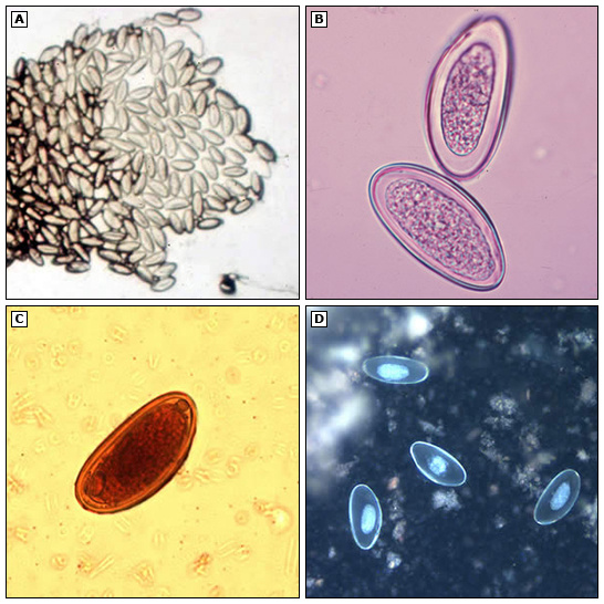 孩子为什么肛周瘙痒,睡觉不安?