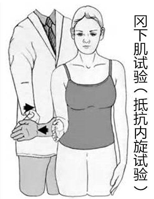 肩袖损伤的辅助检查:金标准:肩关节磁共振肩袖损伤的治疗:保守治疗