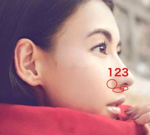 鼻基底在哪里,哪些人适合填充鼻基底