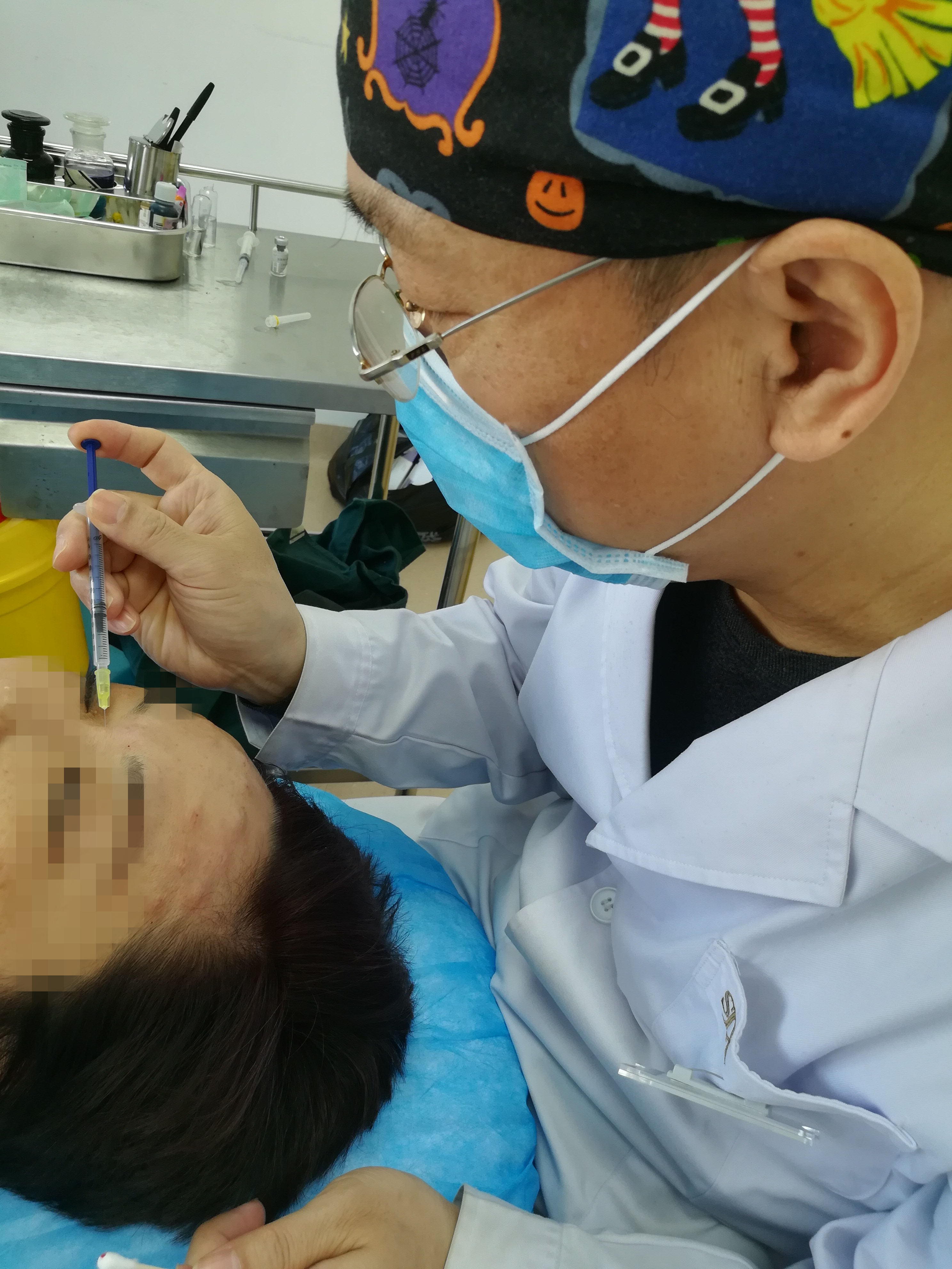 52岁女性面部年轻化—肉毒素注射除皱