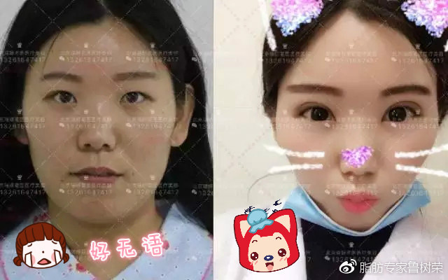 听说你有严重的"自拍小脸症",看过来,帮你"治"