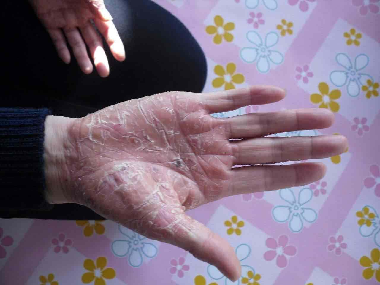 这个春天你还会搔首弄姿吗