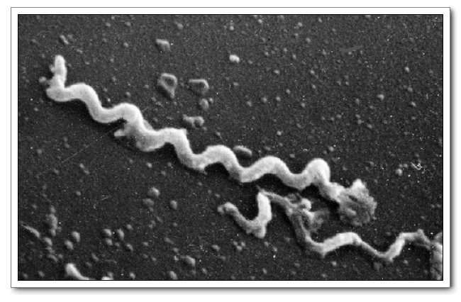 梅毒苍白螺旋体图片