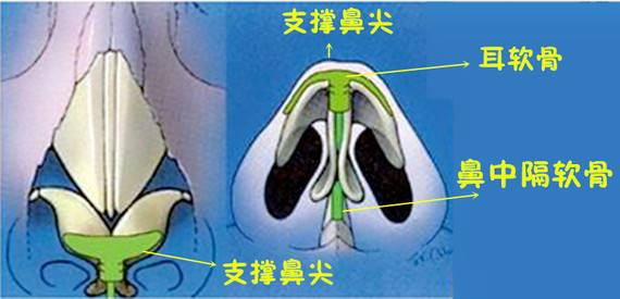 鼻软骨生长图片