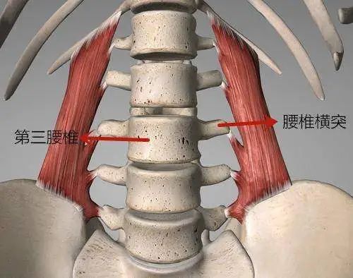 突的腰大肌腰方肌等肌肉持續緊張,容易導致腰椎橫突周圍的疼痛和炎症