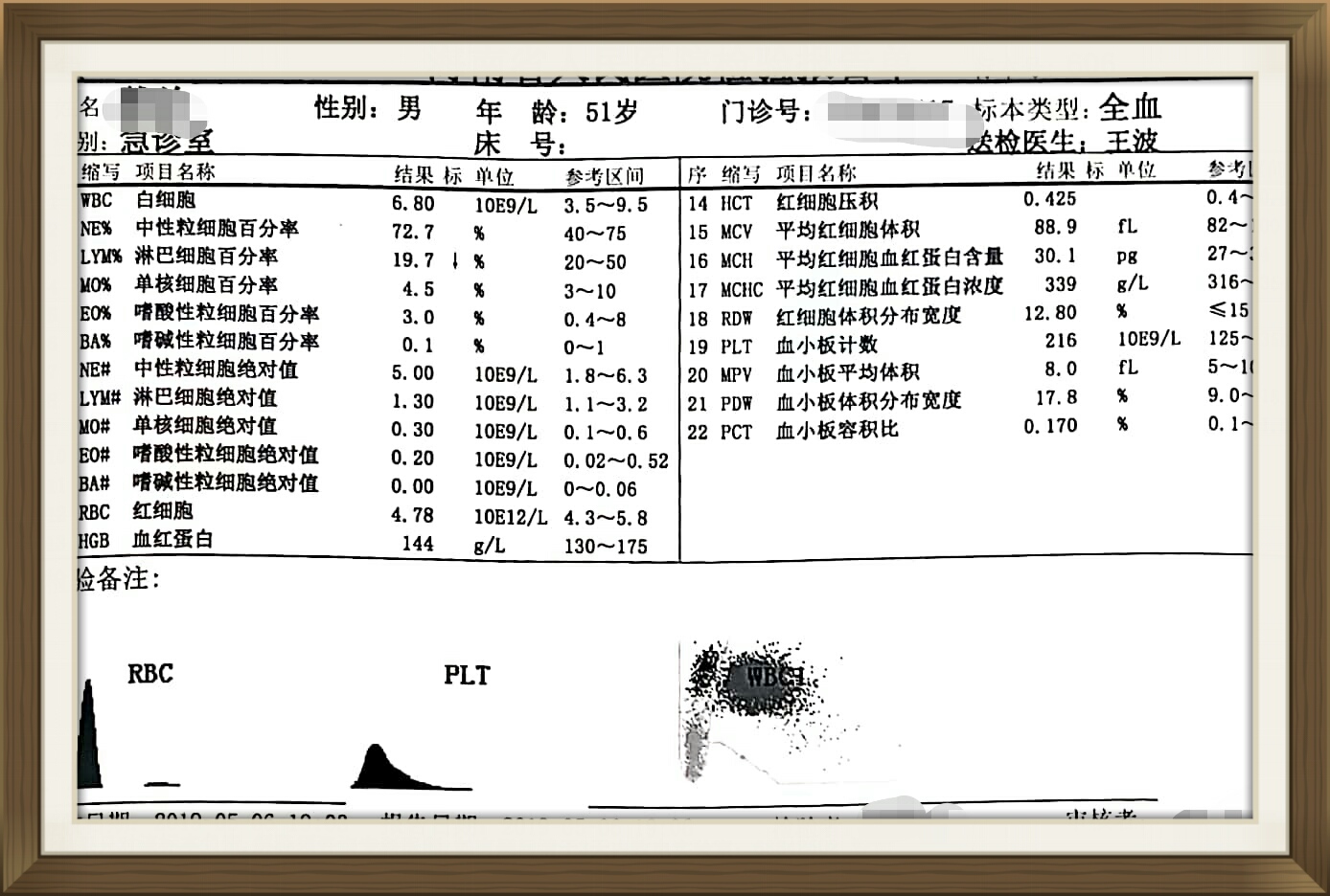 3,从血常规看,淋巴细胞比例下降,白细胞无改变,而胸部ct提示右侧肺弥