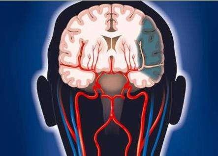 脑梗后遗症太遭罪医生提醒:康复10大原则,身体恢复才顺利