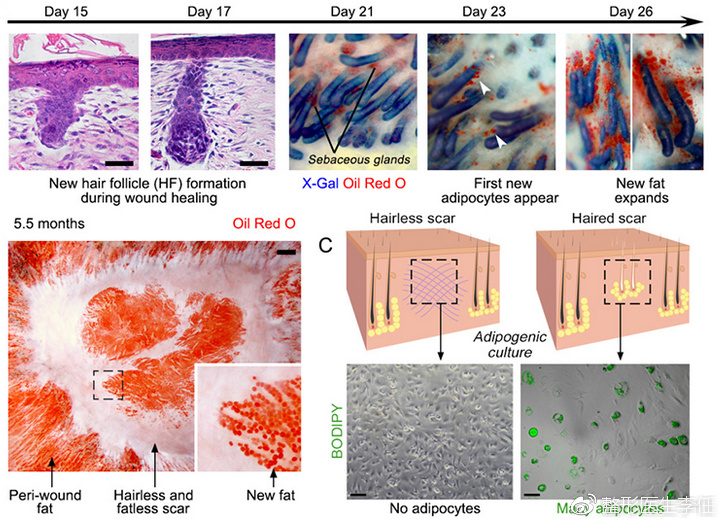 图8.伤口无瘢痕愈合原理