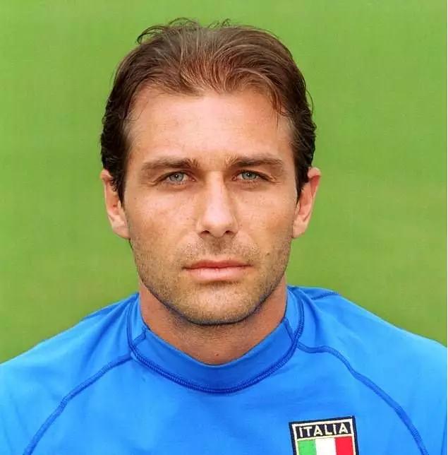 意大利知名足球教练孔蒂,2007年植发至今效果