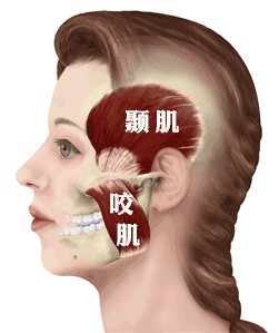 咀嚼肌包括两部分,下颌两侧的咬肌以及太阳穴部位的颞肌.