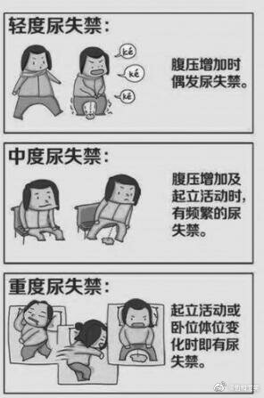什么是压力性尿失禁走路大笑漏尿怎么办